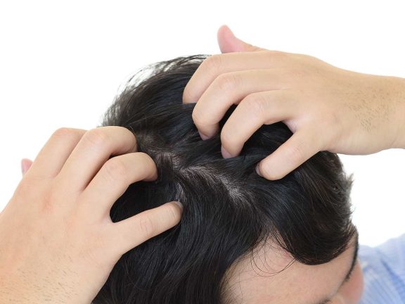 加齢による抜け毛は気になるもの